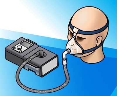 CPAP 面罩和 CPAP 機器