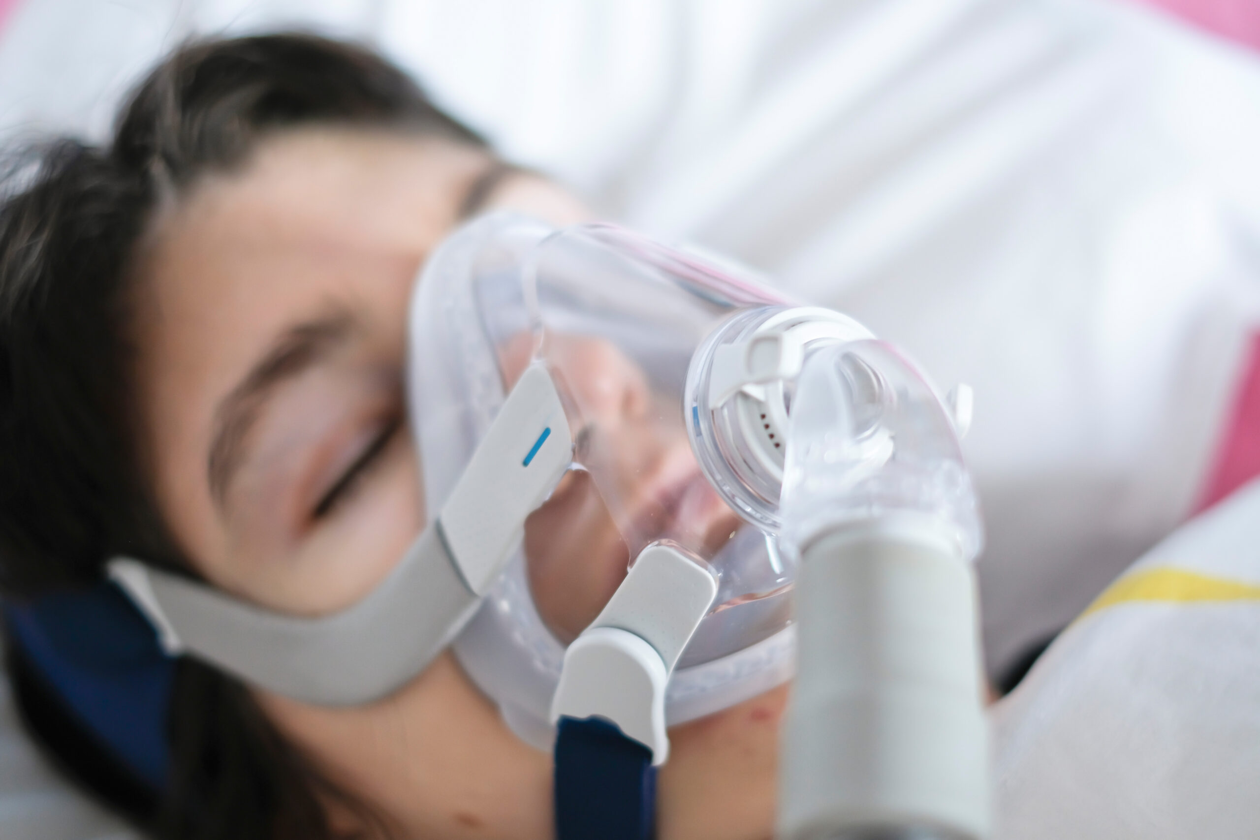 持續氣道正壓通氣 (CPAP) 的副作用是什麼？